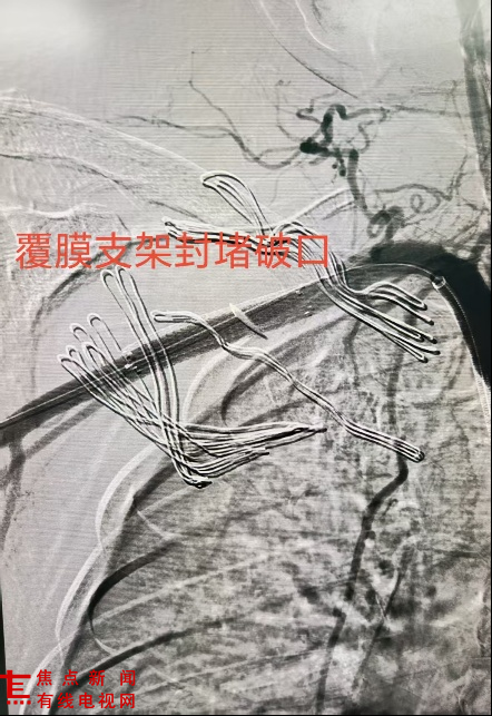 图片4.png 图片4.png